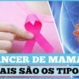 Quais são os tipos de câncer de mama?